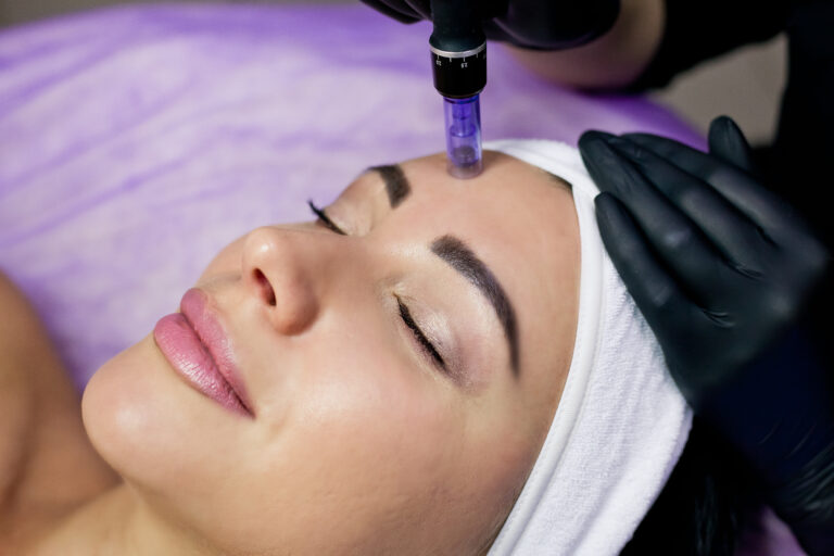 Microdermabrasion Dallas