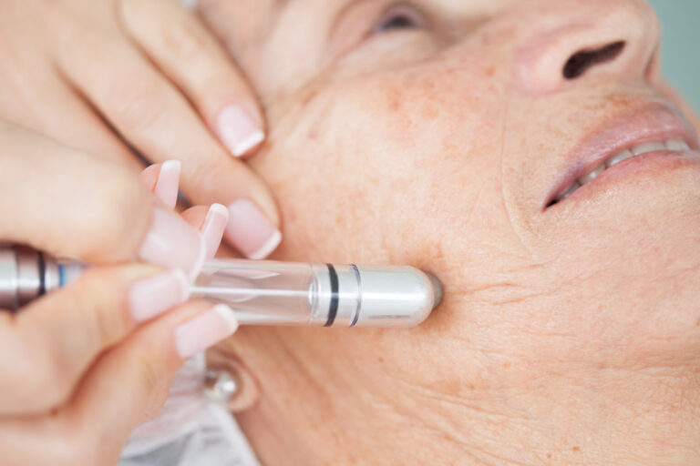 PRP Microneedling Dallas