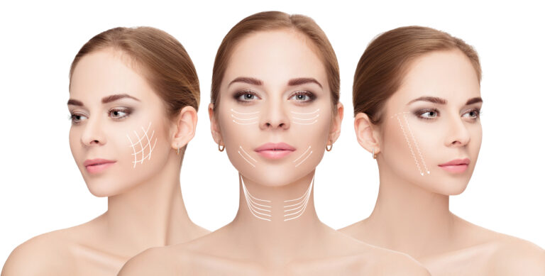 Kybella® Dallas