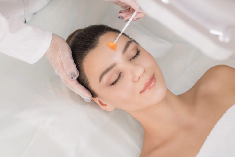 Chemical Peel Dallas & Plano